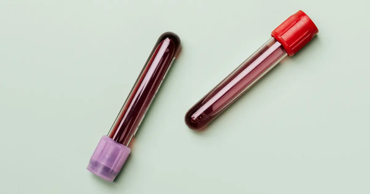 Provette per gli esami del sangue in farmacia